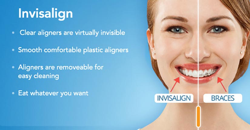 Kalamazoo Invisalign Dentist